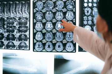 Youth: What Brain Scans & Cadavers Remind Us About Concussion Safety